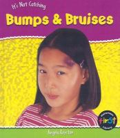 It_s_Not_Catching_Bumps___Bruises